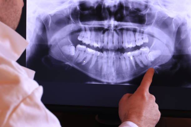 Best Emergency Root Canal Treatment in Chanute, KS