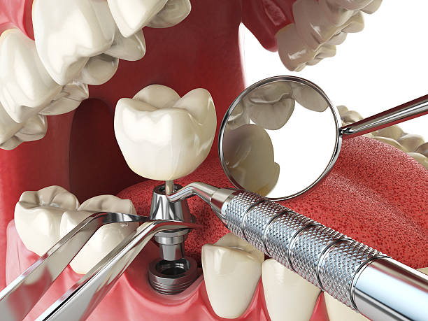 Best Pediatric Emergency Dentist in Chanute, KS